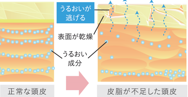 【加齢キューティクル③】「加齢キューティクル」は頭皮の乾燥が原因です