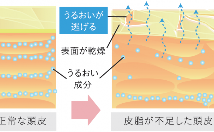 【加齢キューティクル③】「加齢キューティクル」は頭皮の乾燥が原因です