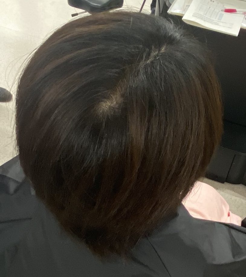 モデル事例アフター（1人目）