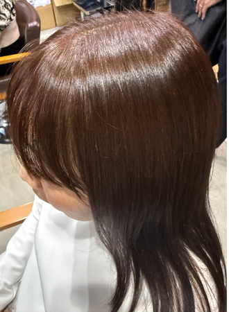 モデル事例アフター（2人目）