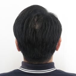 ブラック（ノンジアミンカラー）